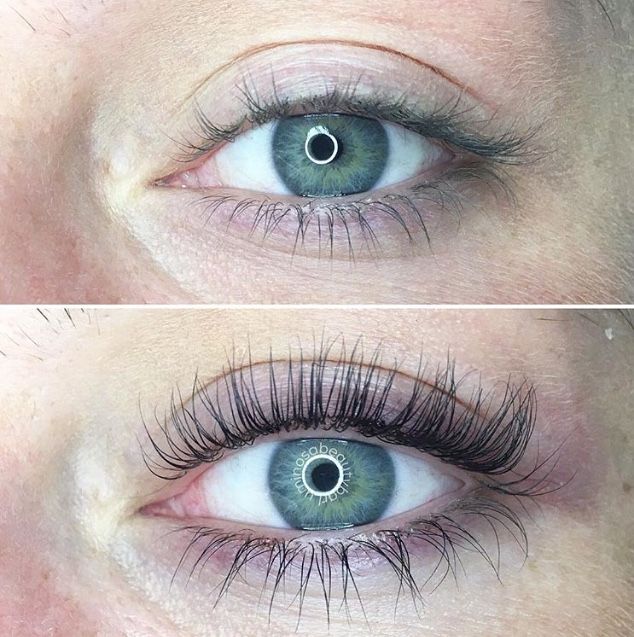 Before and after lash treatment 1